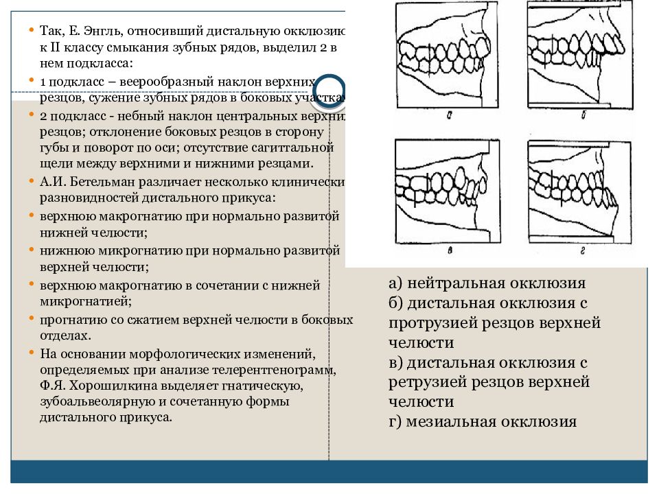 Мезиальная окклюзия презентация ортодонтия