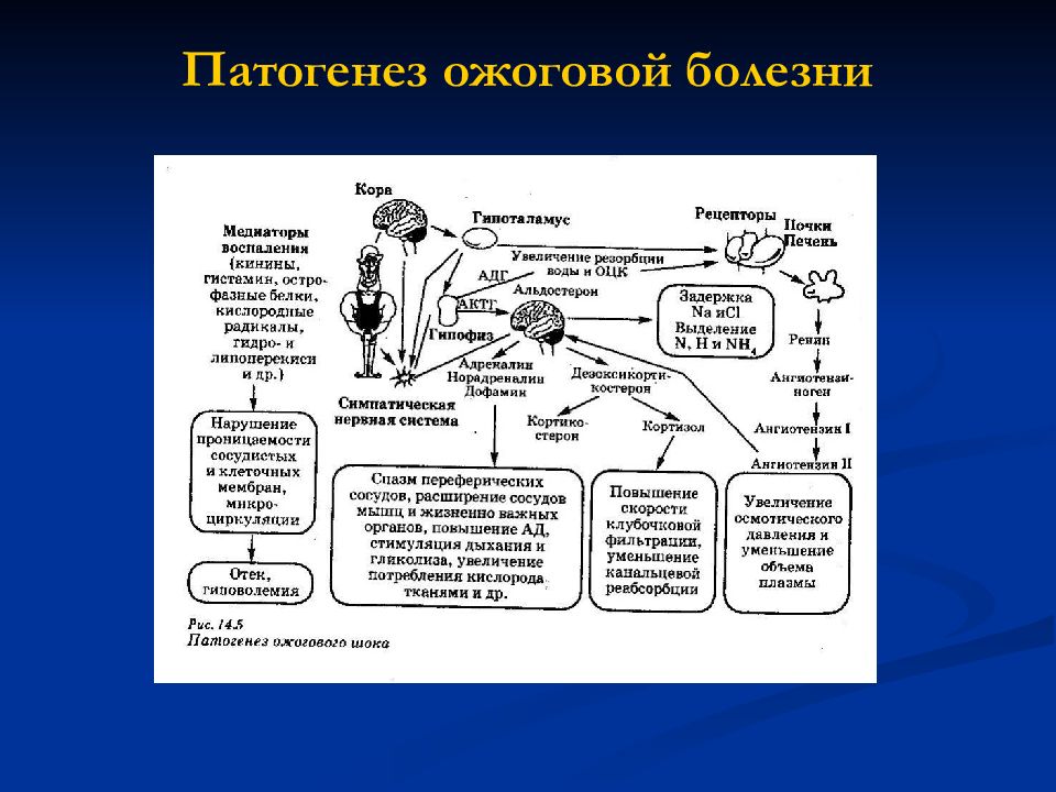 Лечение ожогов схема