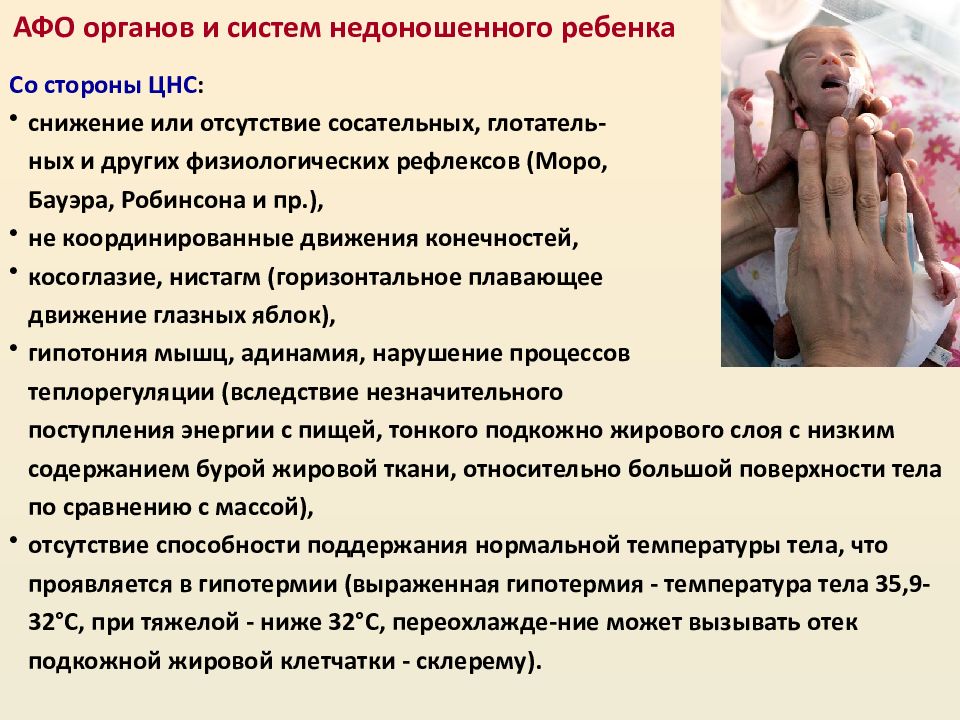 Сестринский уход за недоношенными детьми. Особенности сестринского ухода за недоношенными новорожденными. Рекомендации родителям по уходу за недоношенными детьми. Уход за недоношенным. Домашний уход за недоношенным ребенком.