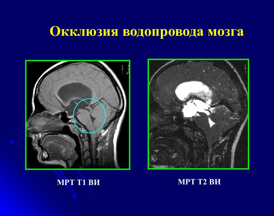 Кт головного мозга презентация