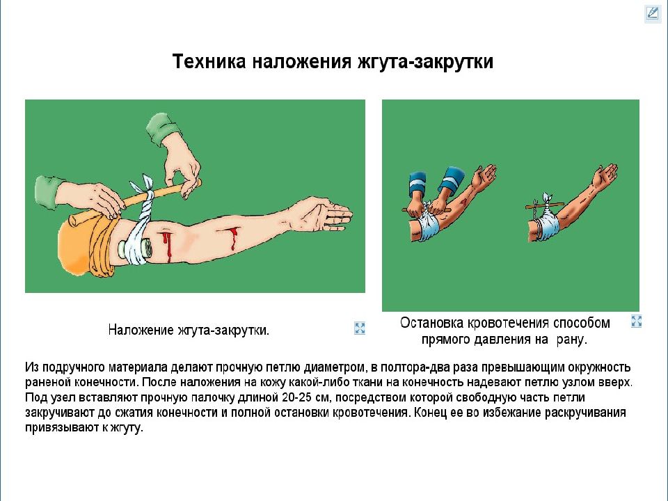 Презентация на тему жгуты