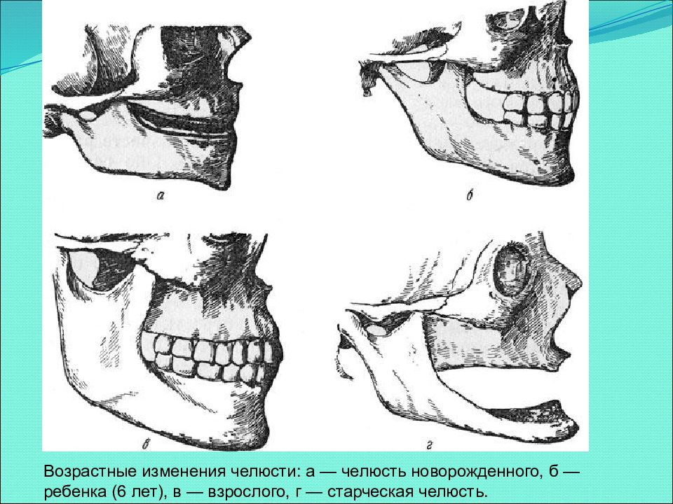 Прогения нижней челюсти. Возрастные изменения челюстей. Старческие изменения в челюсти.