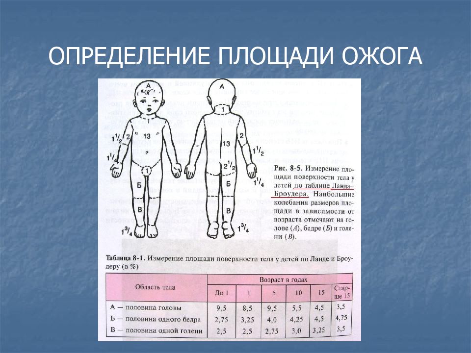 Термические ожоги определение площади ожогов