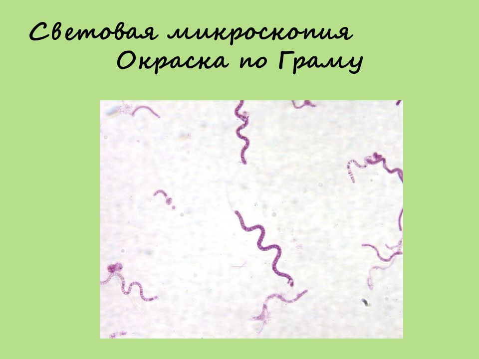 Окраска по граму. Бледная трепонема Романовский Гимзе. Спирохеты окраска по Граму. Лептоспиры окраскс поиграму. Световая микроскопия окраска по Граму.