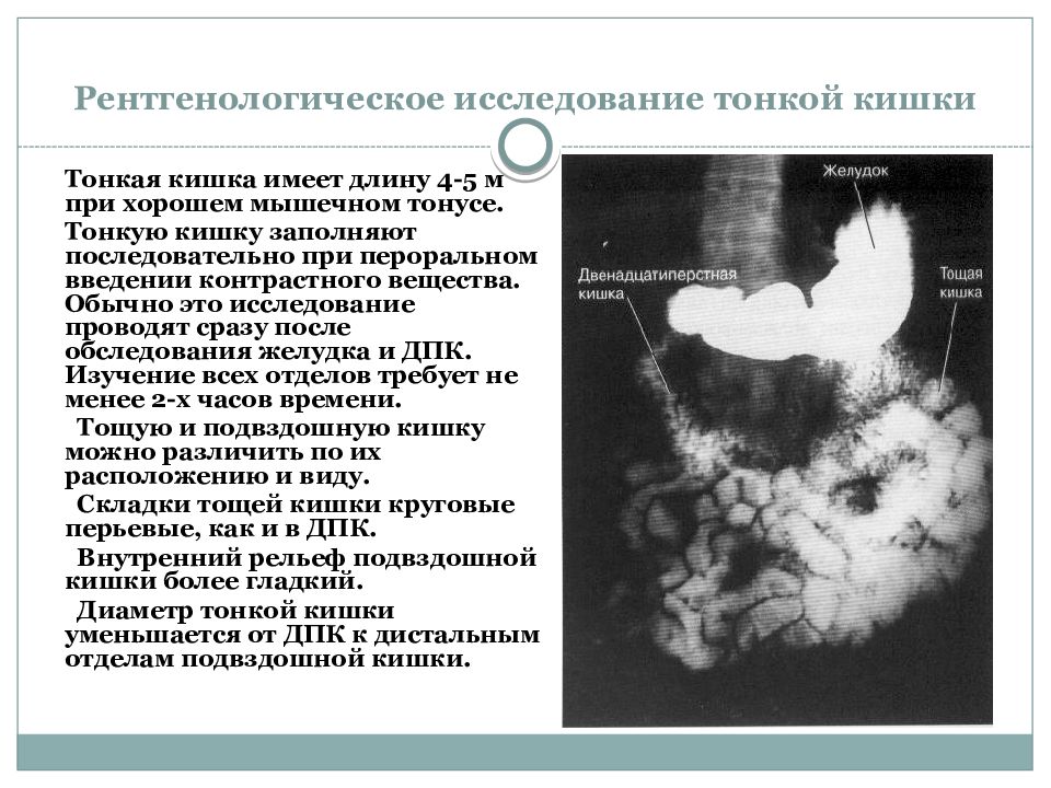 Презентация по тонкой кишке