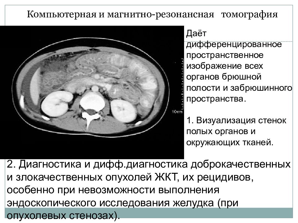 Лучевая диагностика брюшной полости презентация