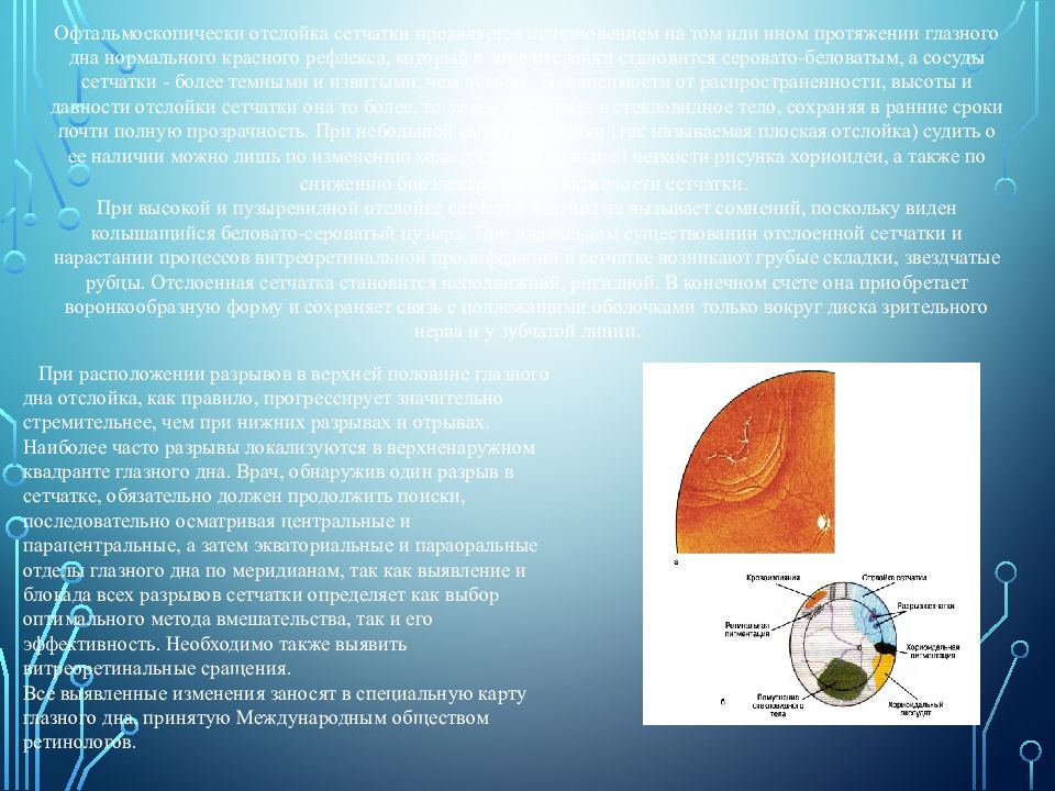 Заболевания сетчатки глаза презентация
