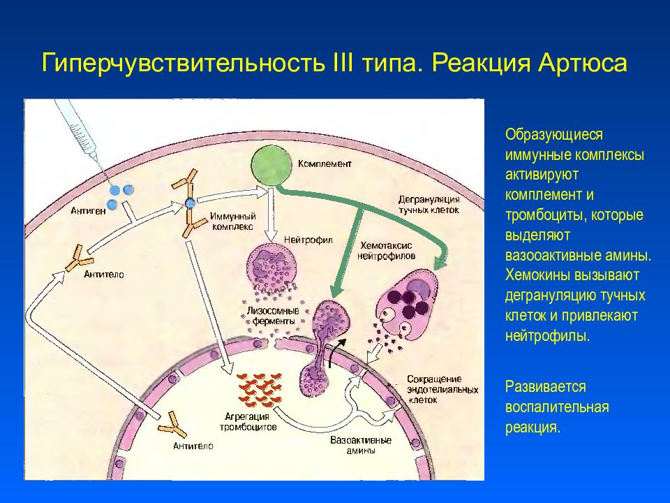иммунокомплексный тип гиперчувствительности. гиперчувствительность 3 типа. реакции гиперчувствительности 3 механизм. гиперчувствительность 2 типа механизм развития. реакция гиперчувствительности 3 типа механизм.