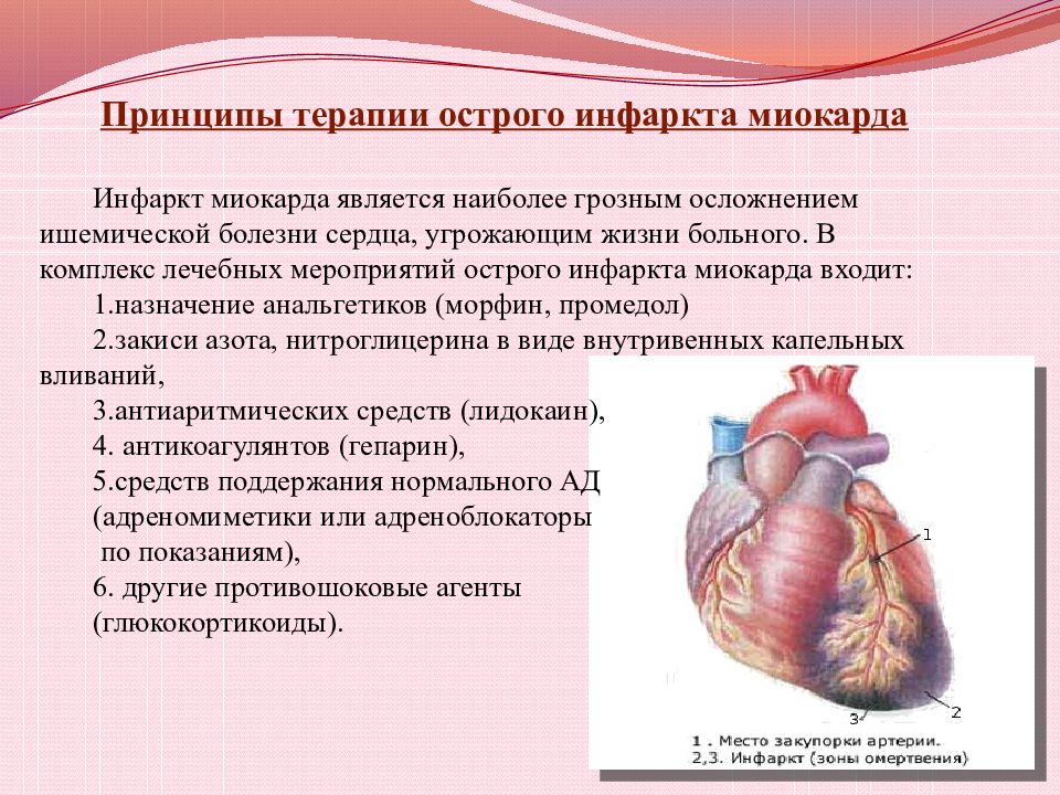 Инфаркт миокарда факультетская терапия презентация