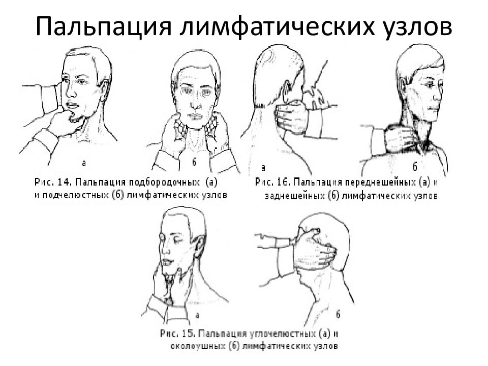 Заполните схему осмотра глотки виды исследования норма патология осмотр подчелюстной области