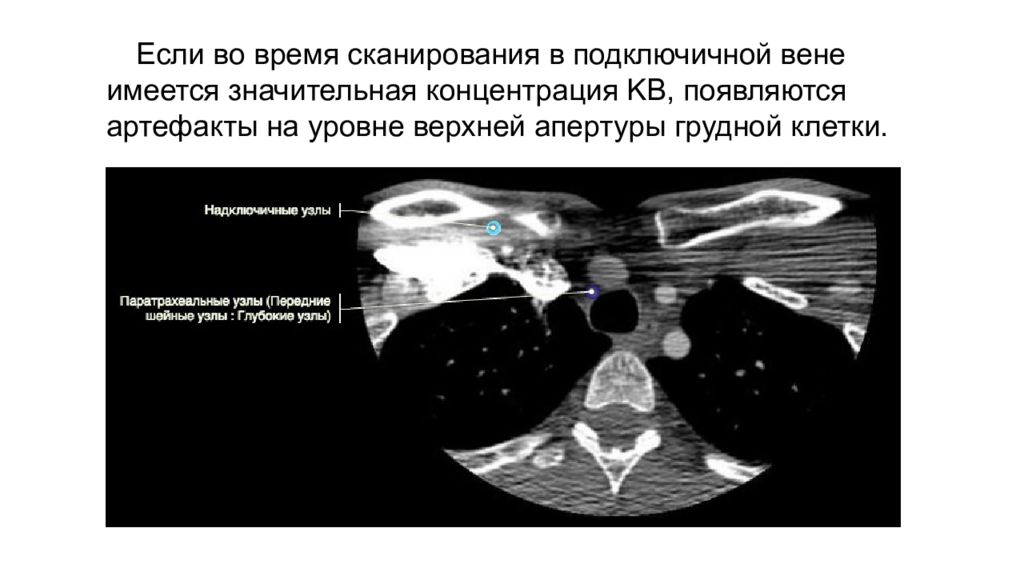 Артефакты кт изображений