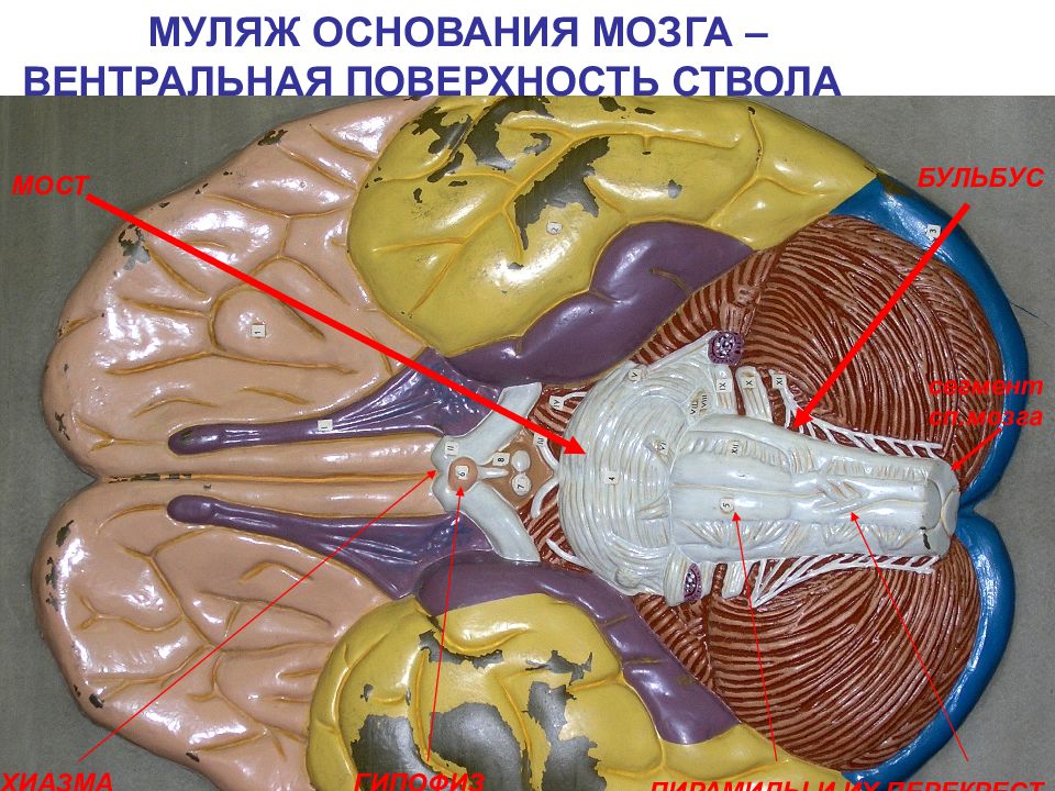 У животного наблюдается гиперфагия раздражение какого отдела мозга дает такую картину