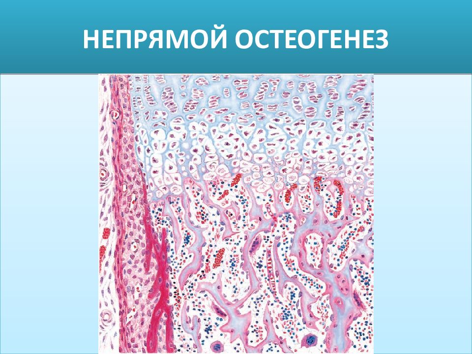 Непрямой остеогенез. Остеогистогенез гистология. Непрямой остеогенез гистология. Мембранозный остеогенез.