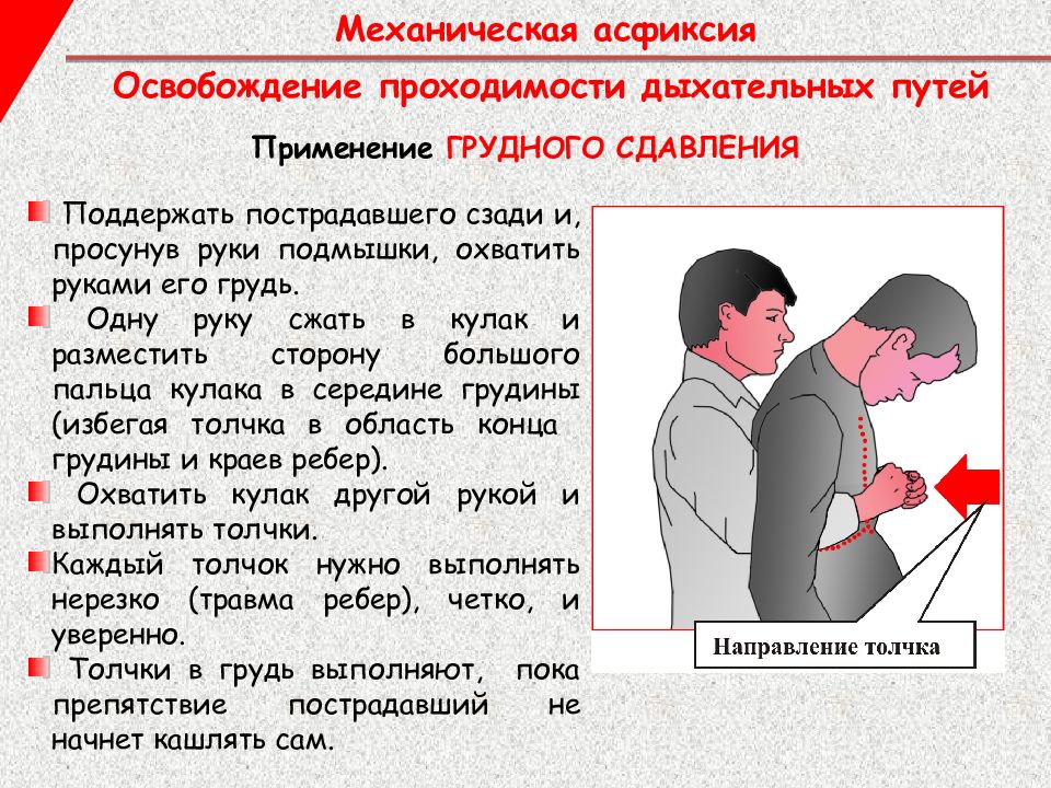 Механическая асфиксия первая помощь презентация