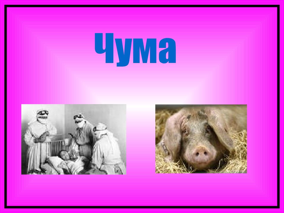 Чума