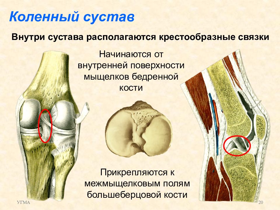 Внутренние мыщелки. Некроз мыщелка коленного сустава. Мыщелок коленного сустава большеберцовой кости. Соединение коленного сустава связки. Мыщелковая кость коленного сустава.