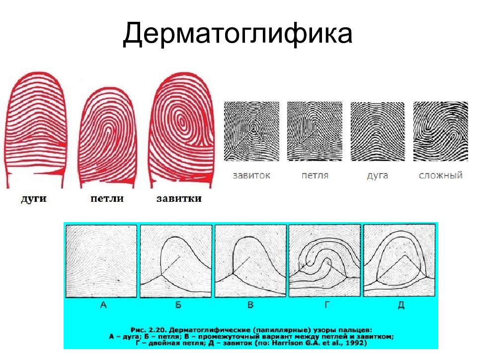 Узоры отпечатков пальцев. Завиток петля дуга дерматоглифика. Дерматоглифика типы узоров. Отпечатки пальцев дерматоглифика. Точка Дельта дерматоглифика.