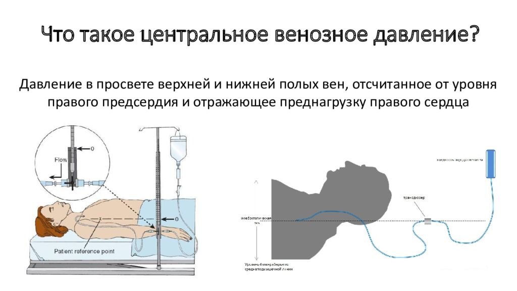 Венозное давление. Измерение ЦВД аппаратом Вальдмана. Измерение центрального венозного давления алгоритм. Измерение ЦВД алгоритм. Измерение центрального венозного давления (ЦВД)..