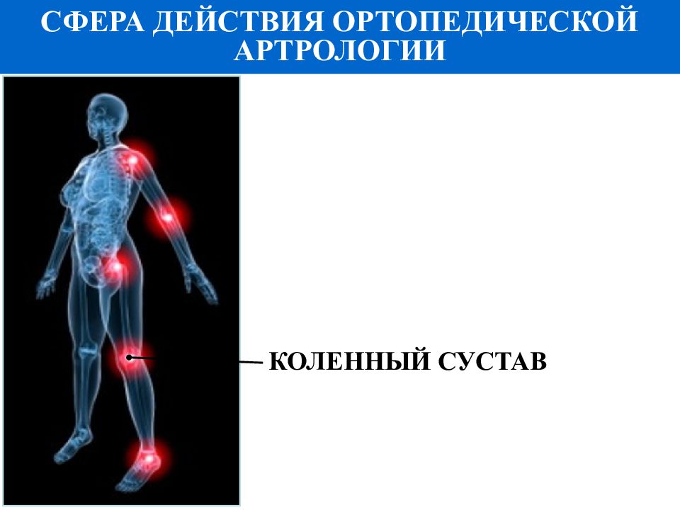 Сфера действуй. Артрология это в медицине определение. Синдромы в артрологии. Основы МР-артрологии картинка.