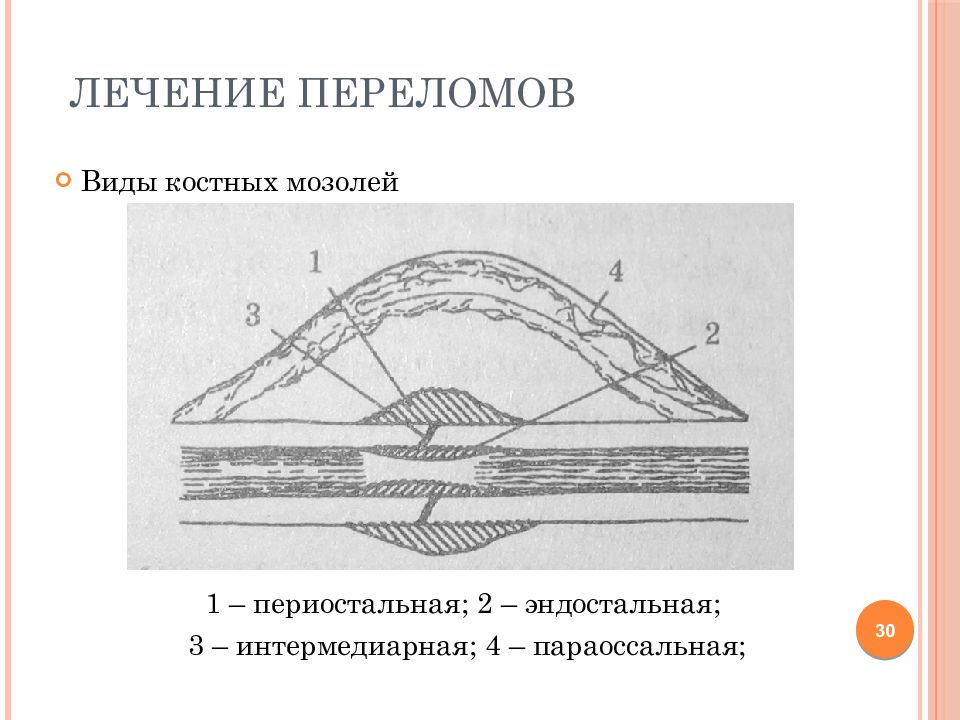 Физиотерапия в травматологии презентация