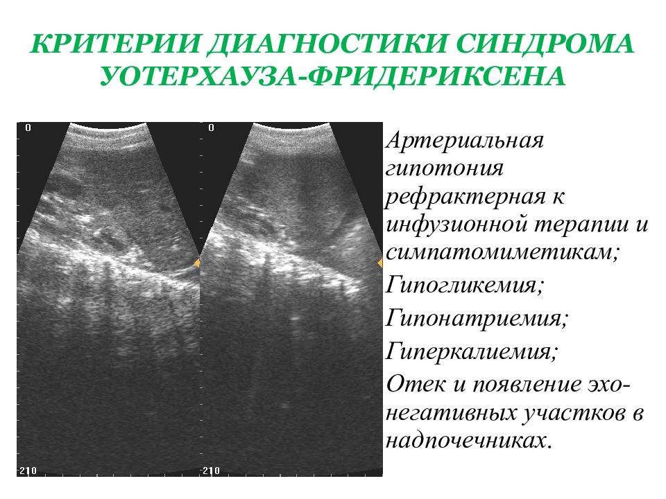 Синдром уотерхауса фридериксена это