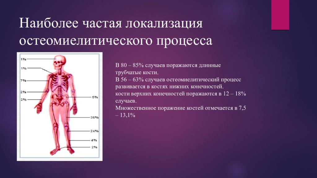 Наиболее частой локализацией