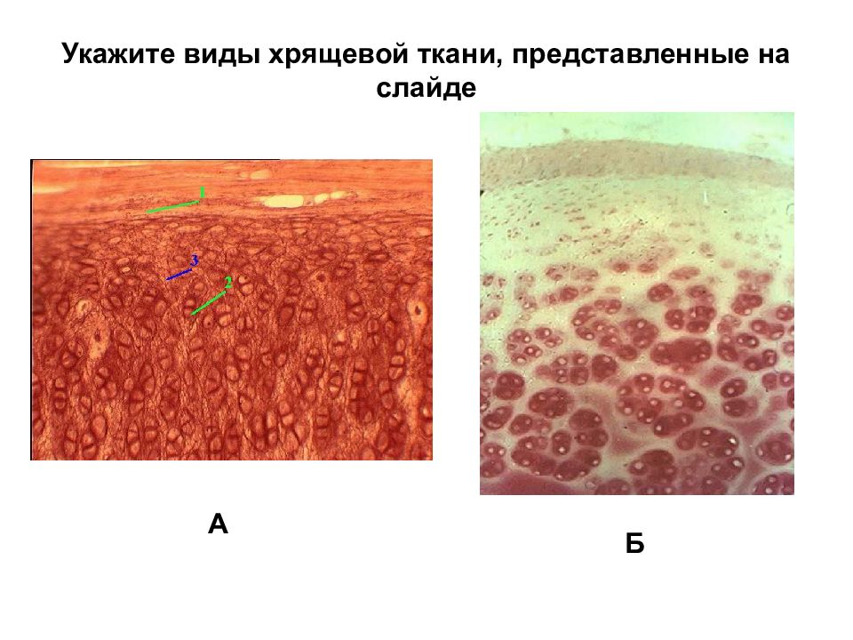 Скелетные ткани презентация