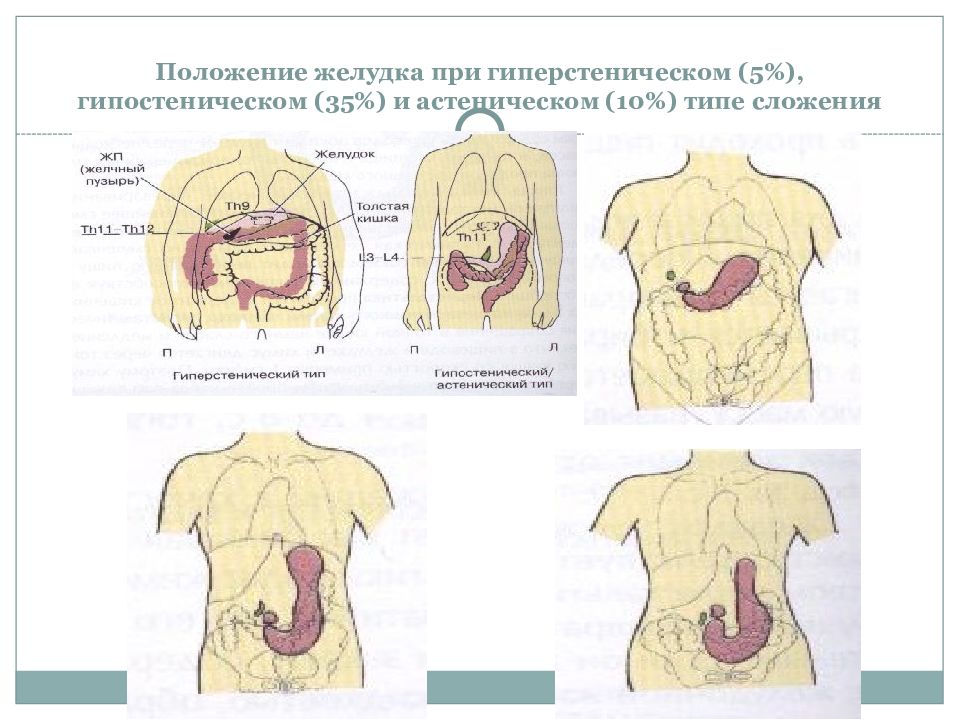 Положение желудка. Положение желудка у человека. Типы положения желудка. Нормальное положение желудка.