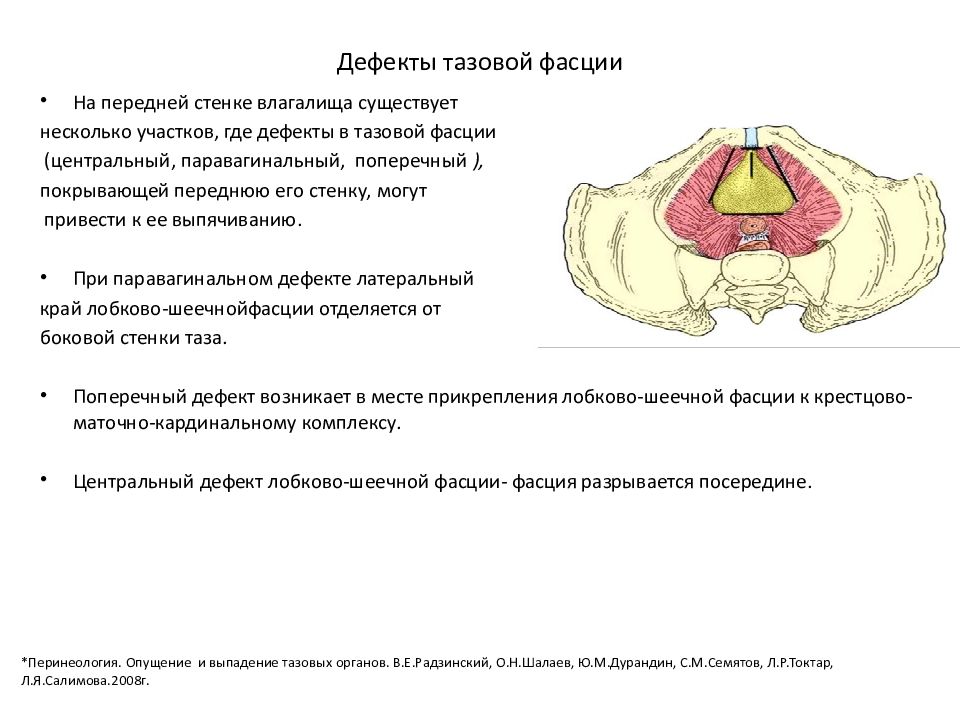 Своды Влагалища Фото