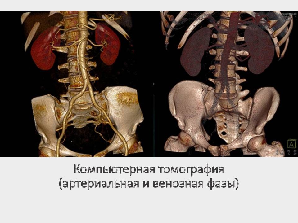 Кт семиотика