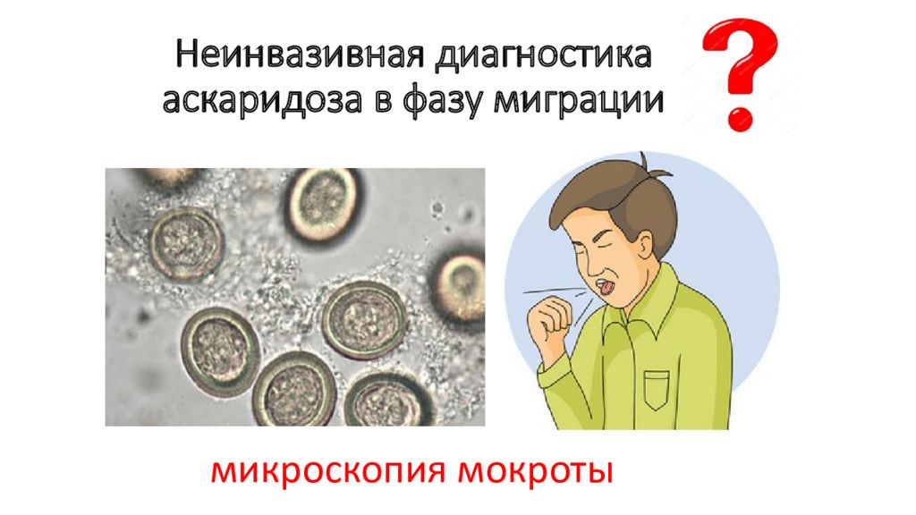 Метод диагностики аскаридоза