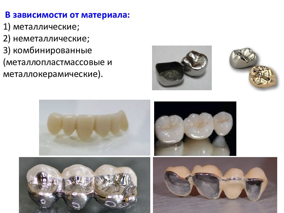 Металлокерамические мостовидные протезы презентация