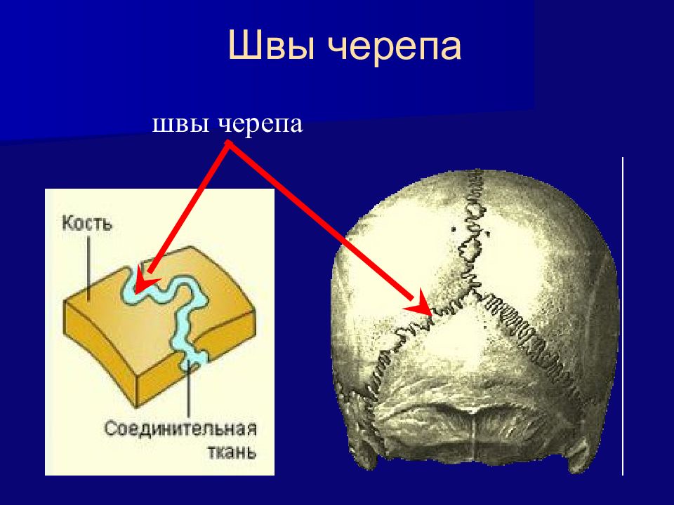 Кости и швы черепа