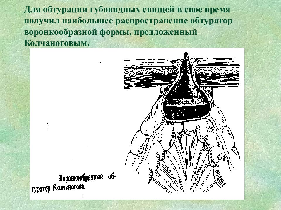 Несформированные свищи. Обтурация Хаскелевича. Обтураторы при кишечных свищах. Обтурация кишечных свищей. Обтураторы при свищах.