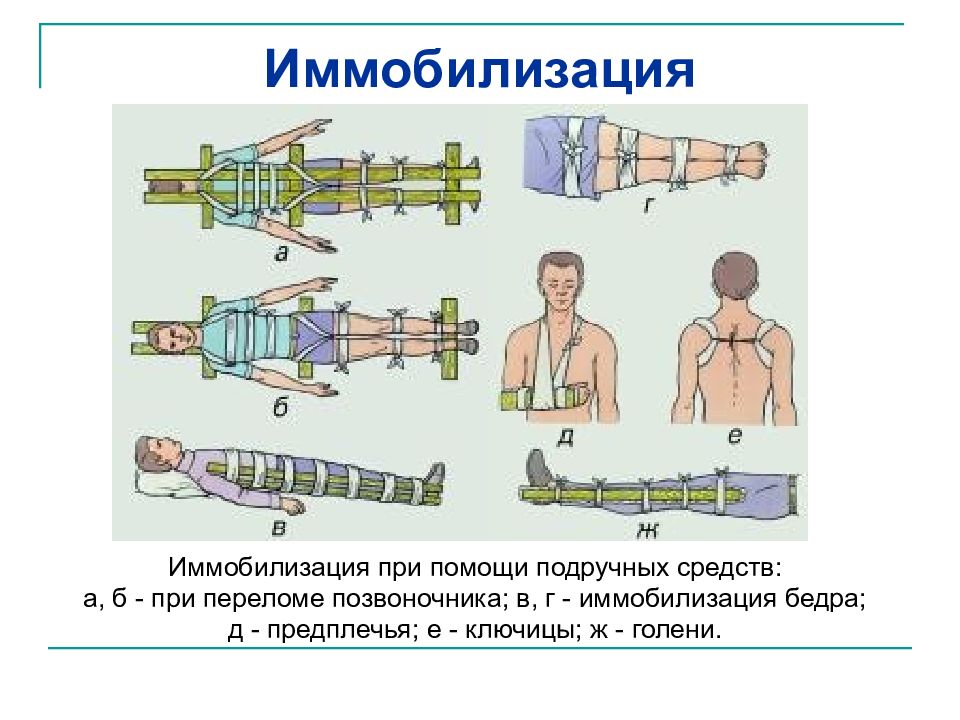 Презентация на тему иммобилизация и транспортировка пострадавших