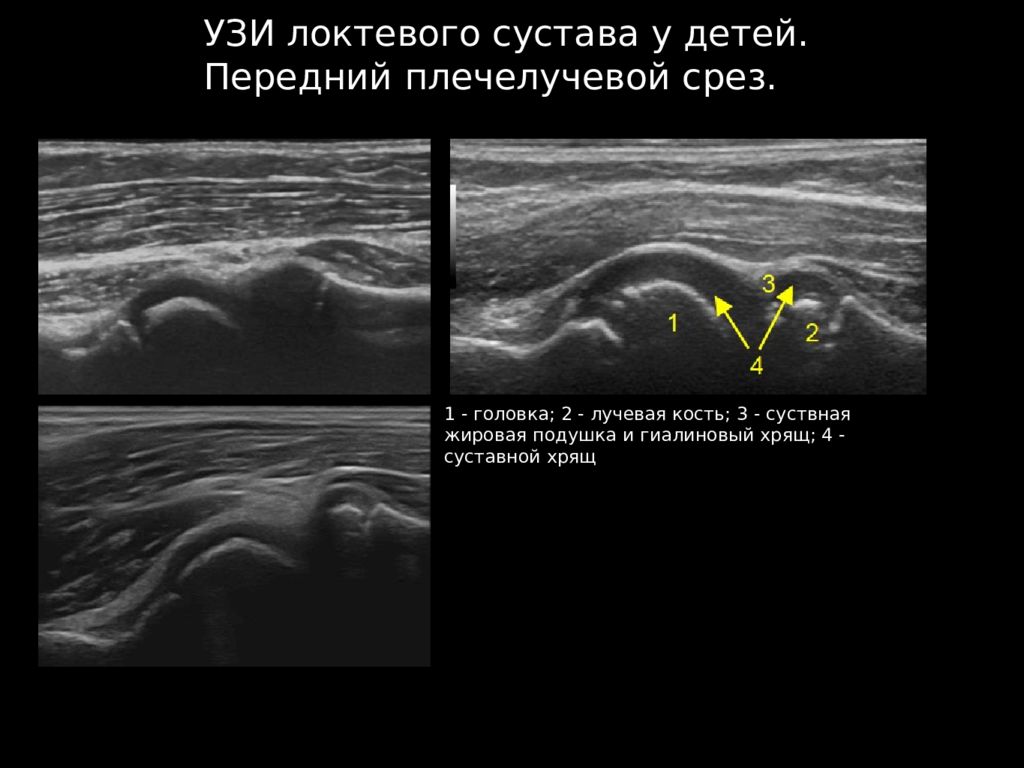 Узи протоколы суставы