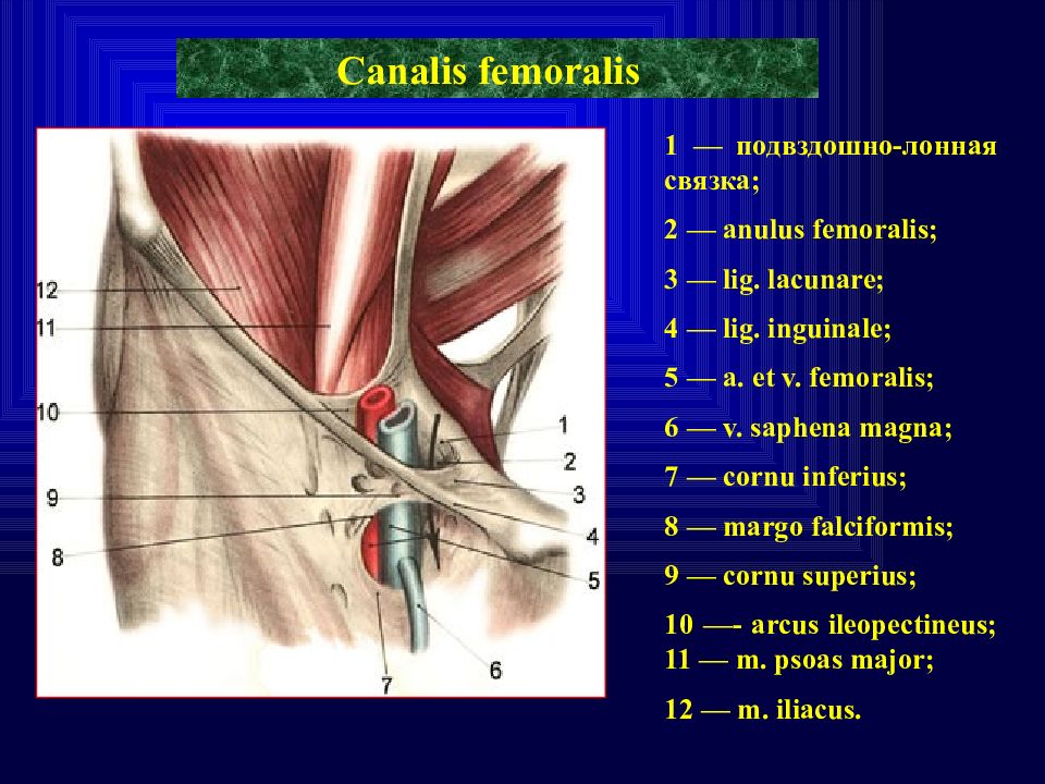 Лакунарная связка. Бедренное кольцо топографическая анатомия. Бедренный канал, Canalis femoralis. Anulus femoralis стенки.