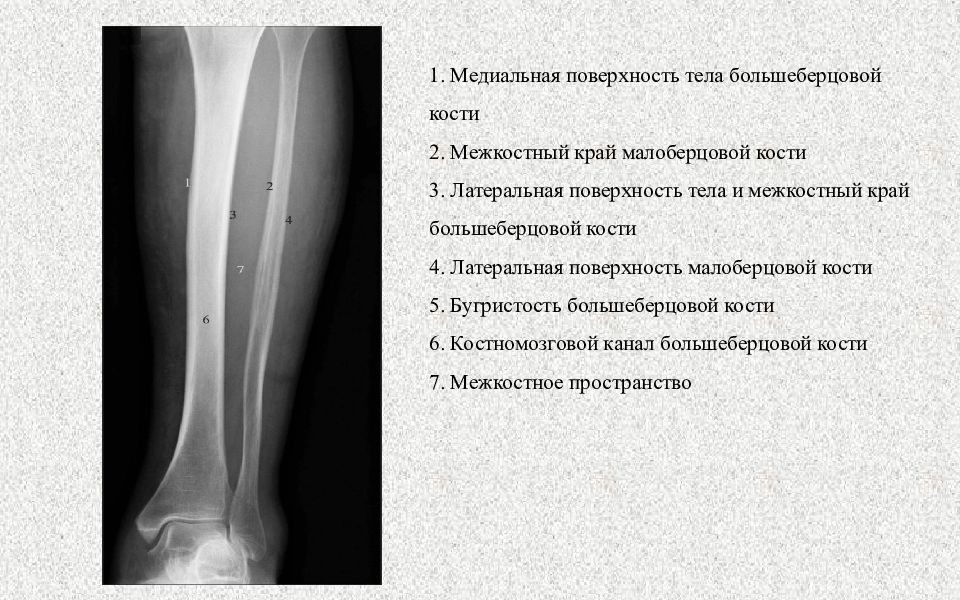 Повреждения нижних конечностей презентация