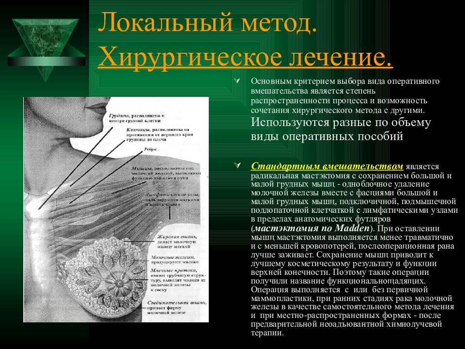 Локальный метод. Клиника опухоли молочной железы. Локальная опухоль молочной железы что это такое. Онкология молочной железы клиника.