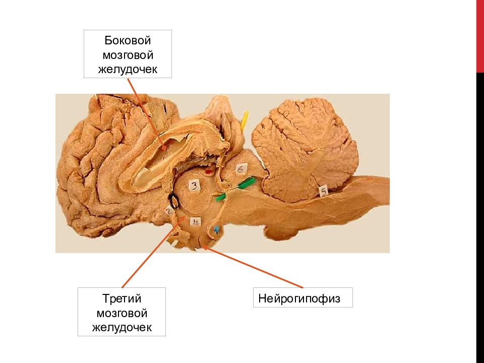 Мозг собаки отделы. Покрышка среднего мозга на препарате. Головной мозг КРС анатомия. Головной мозг коровы анатомия. Покрышка среднего мозга анатомия.