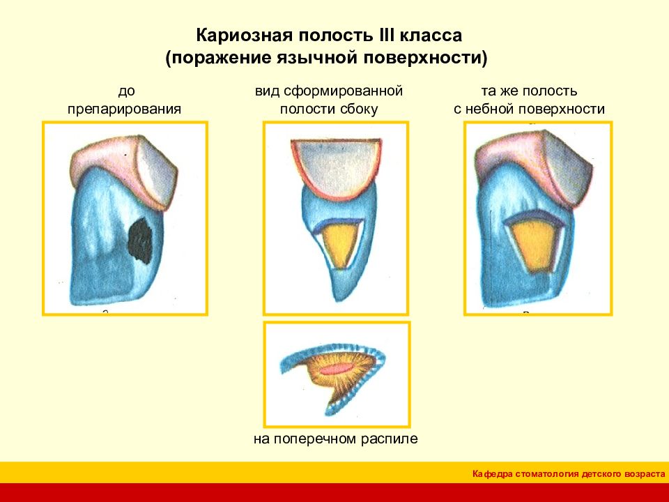 4 класс по блэку презентация