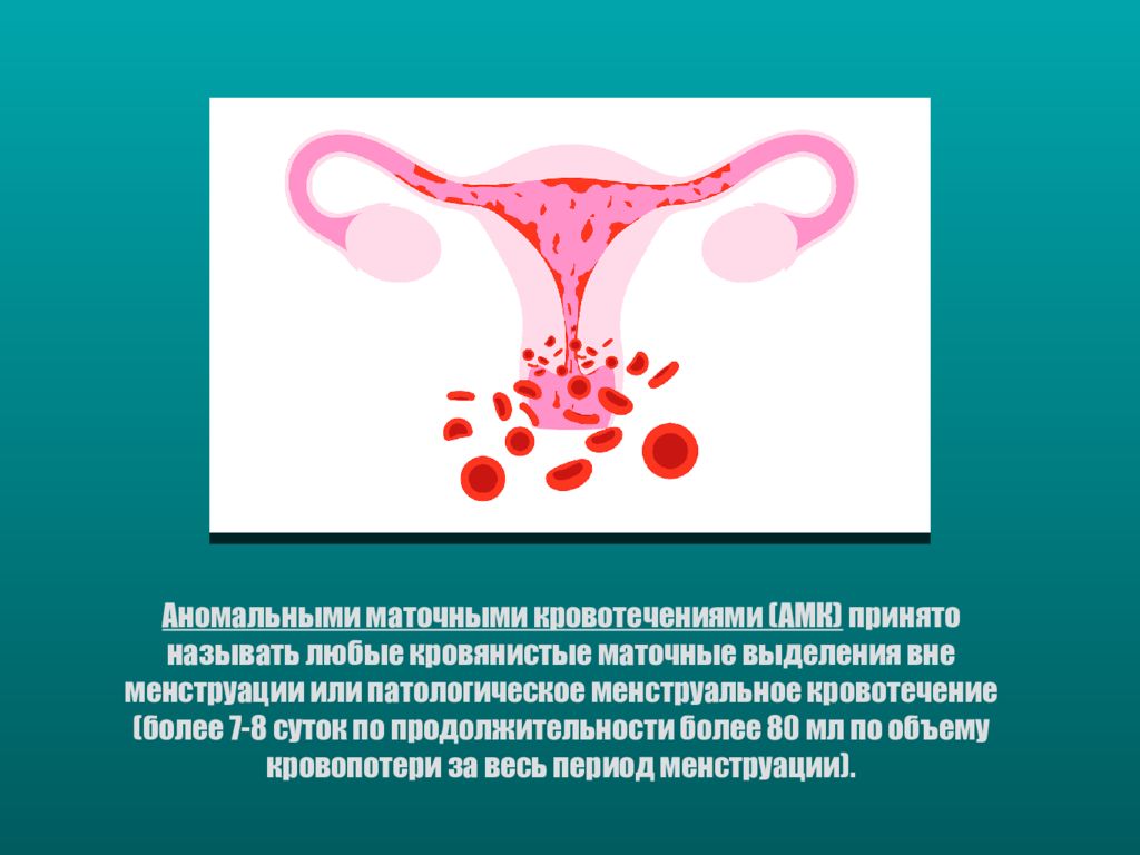 Матка пожилом возрасте. Аномальные маточные КРВОТО. Аномальные маточные кровотечения презентация. Аномальное маточное кровотечение АМК. Ановуляторные маточные кровотечения.