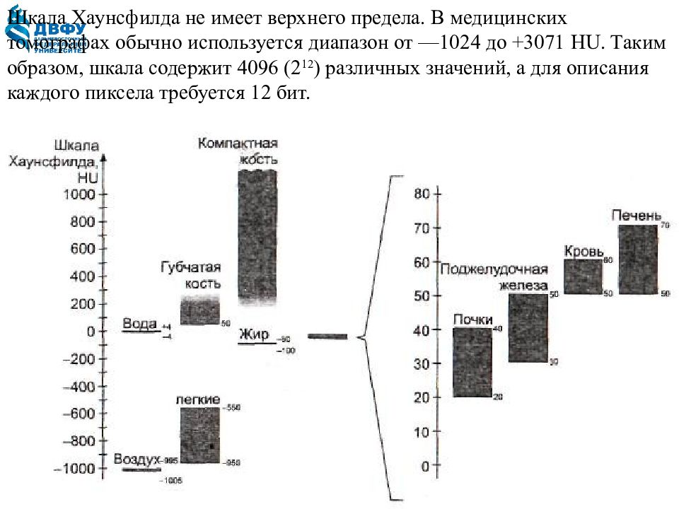 Qt scale. Кт единицы Хаунсфилда. Плотность Хаунсфилда таблица. Единицы Хаунсфилда при компьютерной. Шкала единиц Хаунсфилда.