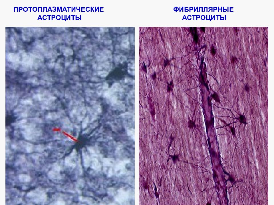 Астроциты. Протоплазматические астроциты гистология. Астроцитарная глия препарат гистология. Протоплазматические и волокнистые астроциты. Фиброзные астроциты.