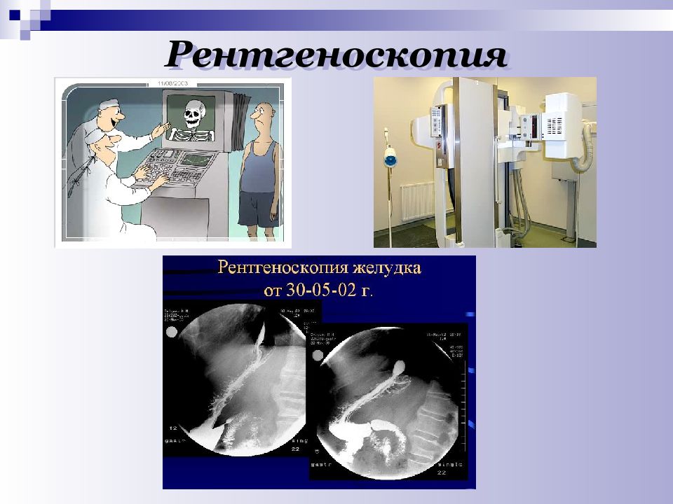 Презентация на тему рентгеноскопия