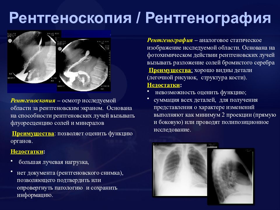 Чем отличается флюорография от рентгена. Рентгеноскопия лучевая диагностика. Разница рентгенограмма и рентгеноскопии. Рентгенография и рентгеноскопия отличия. Чем отличается рентгенография от рентгеноскопии.