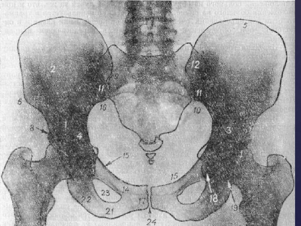 Рентгены анатомия. Кости таза рентген анатомтя. Рентгеноанатомия тазобедренного сустава. Кости таза htynutyанатомия. Тазобедренный сустав рентген анатомия.