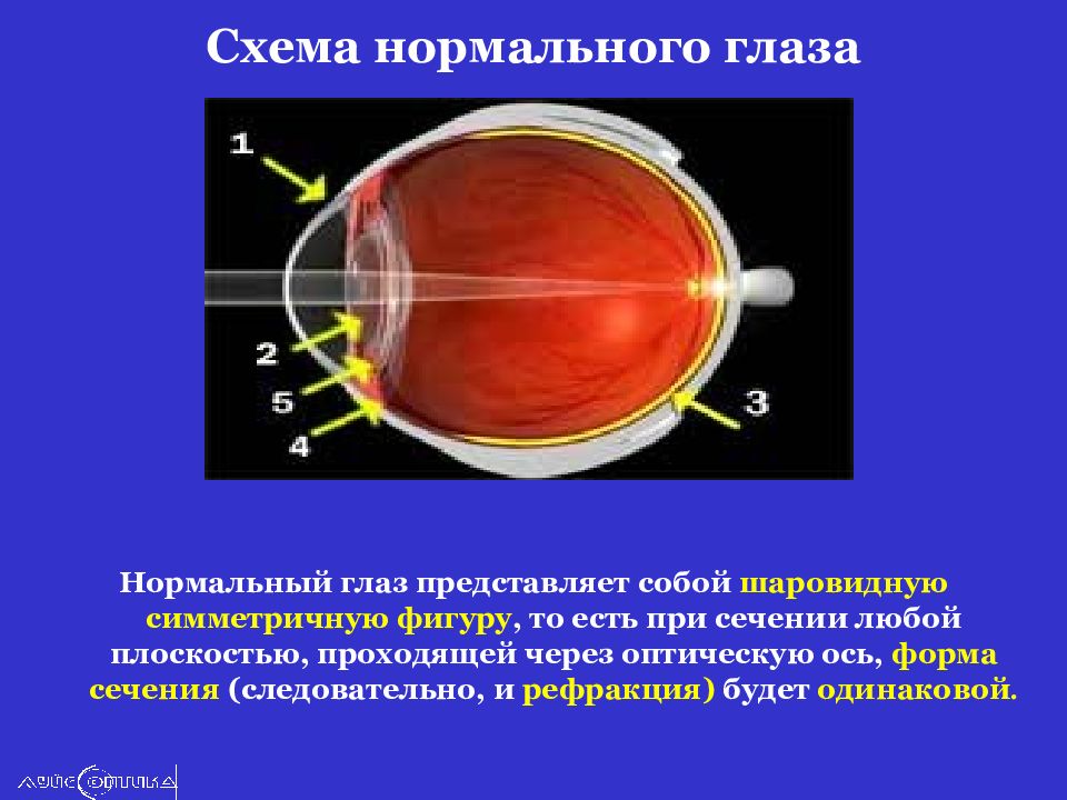 Механизм рефракции глаза. Аномалии рефракции глаза.