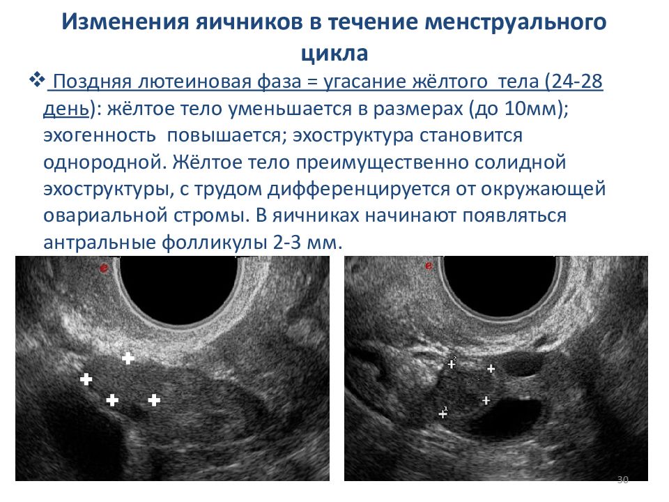 Диаметр яичника. Изменения в яичниках в течение менструального цикла. Изменения яичников в течение цикла. Фаза желтого тела. Изменение в яичниках в течение менструационного цикла.