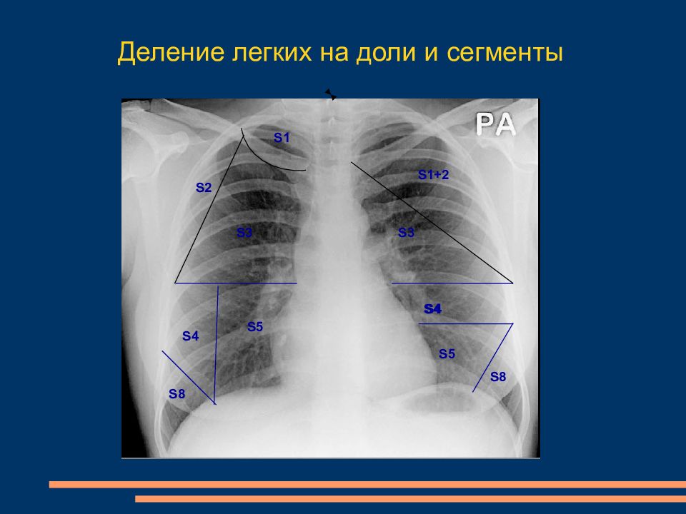 Лучевая диагностика заболеваний легких презентация